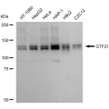 LifeSab™ KD-Validated GTF2I Rabbit mAb (20 μl)