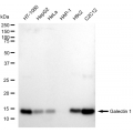 LifeSab™ KD-Validated LGALS1 Rabbit mAb (20 μl)