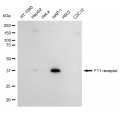 LifeSab™ KD-Validated F11R Rabbit mAb (20 μl)