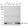 LifeSab™ KD-Validated Galectin 1 Rabbit mAb (20 μl)