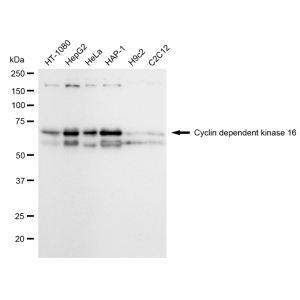 LifeSab™ KD-Validated CDK16 Rabbit mAb (20 μl)