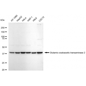 LifeSab™ KD-Validated GOT2 Rabbit mAb (20 μl)