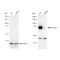 LifeSab™ KD-Validated FOXO1 Rabbit mAb (20 μl)