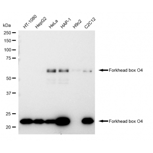 LifeSab™ KD-Validated FOXO4 Rabbit mAb (20 μl)