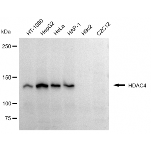 LifeSab™ KD-Validated HDAC4 Rabbit mAb (20 μl)