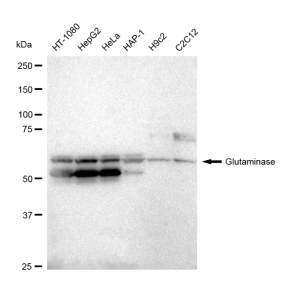 LifeSab™ KD-Validated GLS Rabbit mAb (20 μl)