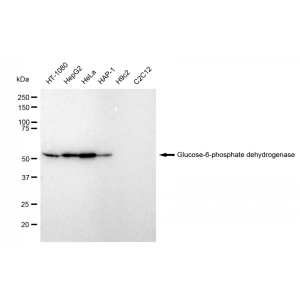 LifeSab™ KD-Validated G6PD Rabbit mAb (20 μl)