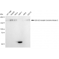 LifeSab™ KD-Validated HER2 Rabbit mAb (20 μl)