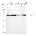 LifeSab™ KD-Validated PKC alpha Rabbit mAb (20 μl)