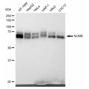 LifeSab™ KD-Validated NUMB Rabbit mAb (20 μl)