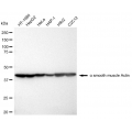 LifeSab™ KD-Validated ACTSA Rabbit mAb (20 μl)