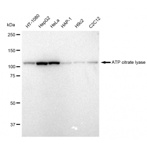 LifeSab™ KD-Validated ACL Rabbit mAb (20 μl)