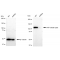 LifeSab™ KD-Validated ACL Rabbit mAb (20 μl)