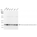 LifeSab™ KD-Validated VAMP2 Rabbit mAb (20 μl)