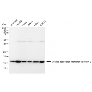 LifeSab™ KD-Validated VAMP2 Rabbit mAb (20 μl)