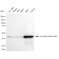 LifeSab™ KD-Validated ACTSA Rabbit mAb (20 μl)