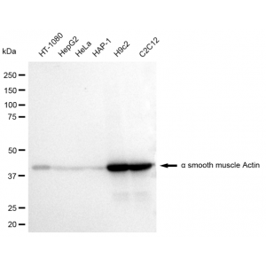 LifeSab™ KD-Validated ACTSA Rabbit mAb (20 μl)