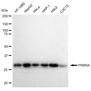 LifeSab™ KD-Validated PRKRA Rabbit mAb (20 μl)