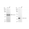 LifeSab™ KD-Validated PRKRA Rabbit mAb (20 μl)