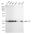 LifeSab™ KD-Validated CLPP Rabbit mAb (20 μl)