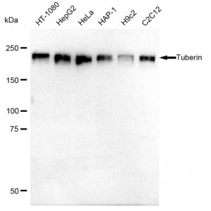 LifeSab™ KD-Validated Tuberin Rabbit mAb (20 μl)