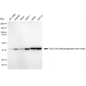 LifeSab™ KD-Validated ACAD3 Rabbit mAb (20 μl)