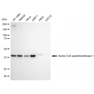 LifeSab™ KD-Validated ACAT Rabbit mAb (20 μl)