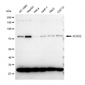 LifeSab™ KD-Validated ACSS2 Rabbit mAb (20 μl)