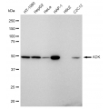 LifeSab™ KD-Validated ADK Rabbit mAb (20 μl)