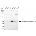 LifeSab™ KD-Validated CDKN1B Rabbit mAb (20 μl)