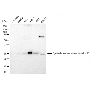 LifeSab™ KD-Validated CDKN1B Rabbit mAb (20 μl)