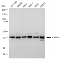 LifeSab™ KD-Validated ALKBH1 Rabbit mAb (20 μl)