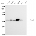 LifeSab™ KD-Validated Smad2 Rabbit mAb (20 μl)