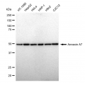 LifeSab™ KD-Validated ANX7 Rabbit mAb (20 μl)