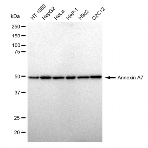 LifeSab™ KD-Validated ANX7 Rabbit mAb (20 μl)