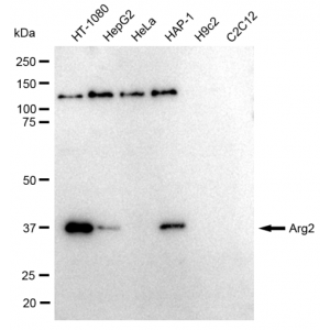 LifeSab™ KD-Validated Arg2 Rabbit mAb (20 μl)