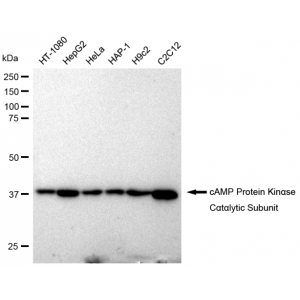 LifeSab™ KD-Validated PKACA Rabbit mAb (20 μl)