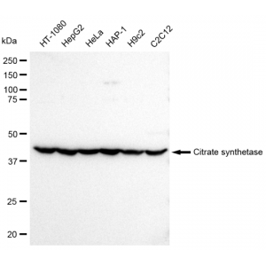 LifeSab™ KD-Validated Citrate Synthetase Rabbit mAb (20 μl)