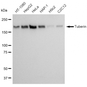 LifeSab™ KD-Validated Tuberin Rabbit mAb (20 μl)