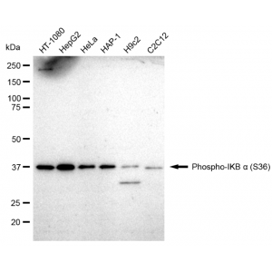 LifeSab™ Phospho-IKBA (S36) Rabbit mAb (20 μl)