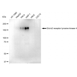 LifeSab™ HER4 Rabbit mAb (20 μl)