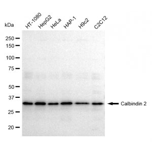 LifeSab™ CALB2 Rabbit mAb (20 μl)