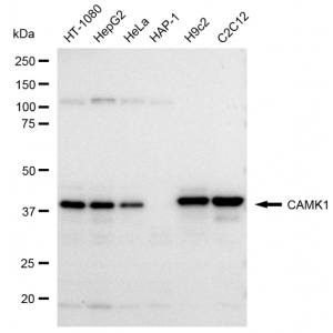 LifeSab™ CAMK1 Rabbit mAb (20 μl)