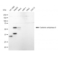 LifeSab™ CAIX Rabbit mAb (20 μl)