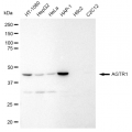 LifeSab™ AGTR1 Rabbit mAb (20 μl)