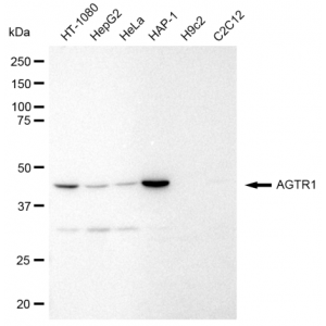 LifeSab™ AGTR1 Rabbit mAb (20 μl)