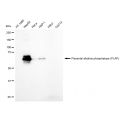 LifeSab™ PLAP Rabbit mAb (20 μl)