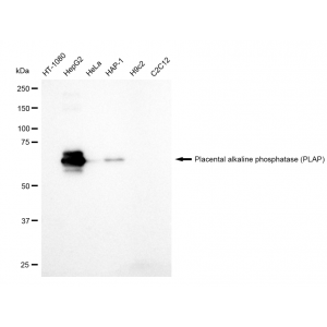 LifeSab™ PLAP Rabbit mAb (20 μl)