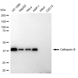 LifeSab™ CTSB Rabbit mAb (20 μl)