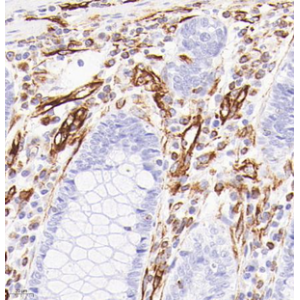 Anti-Vimentin Mouse mAb (50 μl)